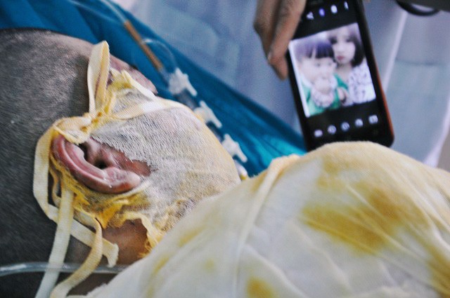 Vụ 2 cô gái bị thiêu sống ở Vĩnh Phúc: Nằm trên giường bệnh, người mẹ đau đớn nhìn con qua màn hình điện thoại cho vơi nỗi nhớ - Ảnh 4.