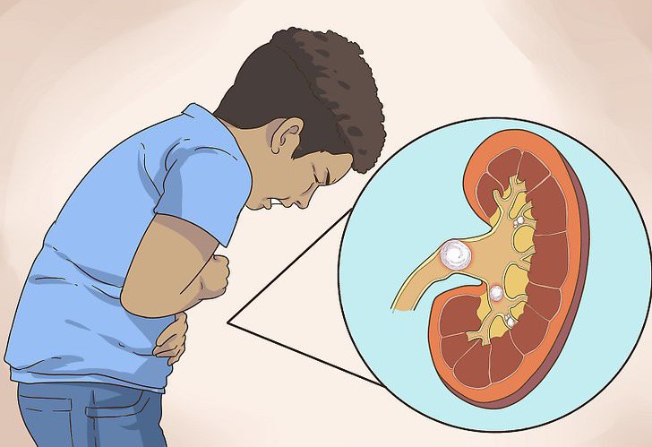 Người Việt cứ giữ thói quen ăn mặn mà không biết có thể phải đối mặt với hàng loạt tác hại này - Ảnh 3.