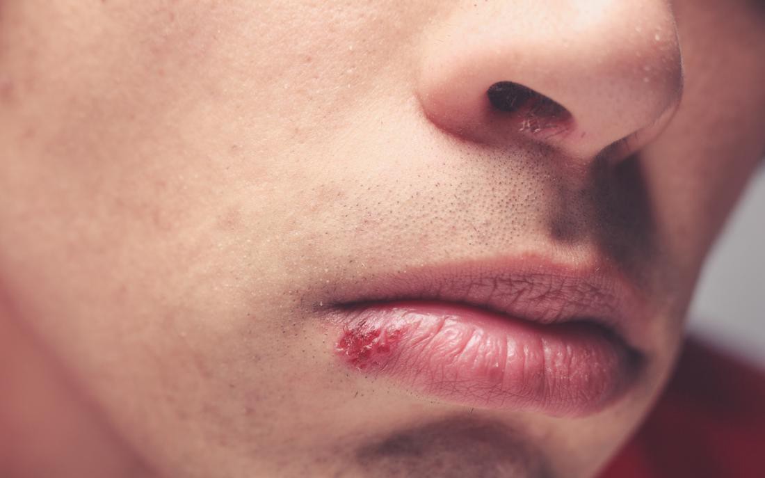 Tỏi kh&ocirc;ng trừ t&agrave; được m&agrave; n&oacute; c&oacute; 11 c&ocirc;ng dụng hữu hiệu sau cho cơ thể - Ảnh 3.