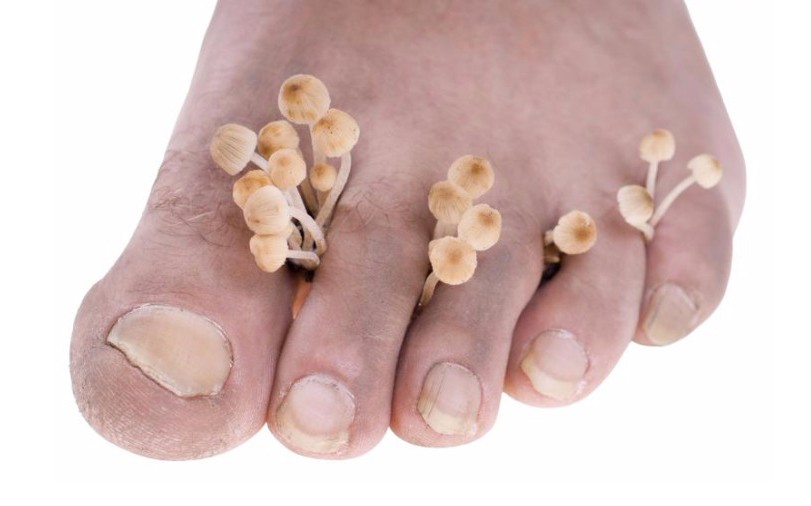 Tỏi kh&ocirc;ng trừ t&agrave; được m&agrave; n&oacute; c&oacute; 11 c&ocirc;ng dụng hữu hiệu sau cho cơ thể - Ảnh 7.