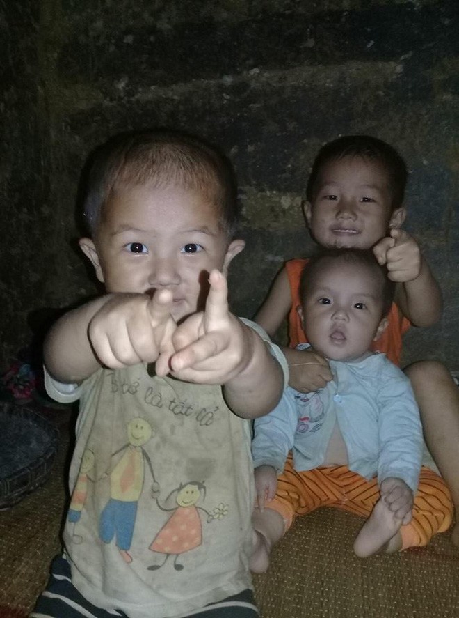 T&igrave;nh cảnh khốn kh&oacute; của người đ&agrave;n &ocirc;ng d&acirc;n tộc M&ocirc;ng bị điện cao thế giật bỏng to&agrave;n th&acirc;n - Ảnh 4.
