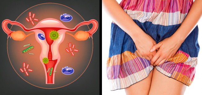 Thử không tắm vài tháng và đây là cái kết đắng mà bạn sẽ nhận được - Ảnh 4.