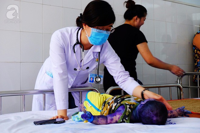 Mẹ không chích ngừa trước sinh, hàng loạt trẻ dưới 3 tháng tuổi mắc bệnh thủy đậu nhập viện tại TP.HCM - Ảnh 5. Mẹ không chích ngừa trước sinh, hàng loạt trẻ dưới 3 tháng tuổi mắc bệnh thủy đậu nhập viện tại TP.HCM - Ảnh 5.