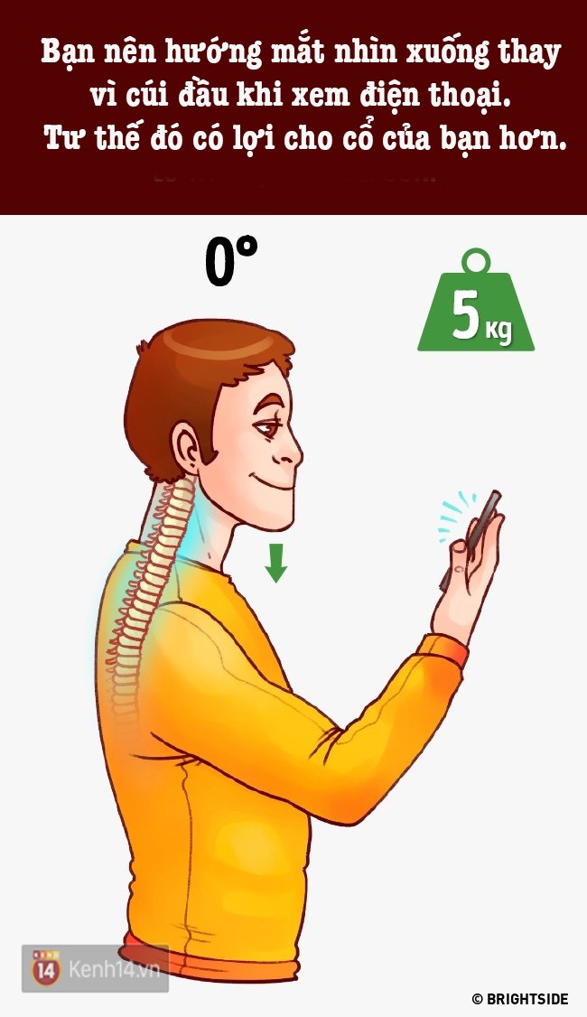 Nằm trên giường dùng điện thoại suốt mấy tiếng, người đàn ông bị thoái hóa đốt sống cổ - Ảnh 4.