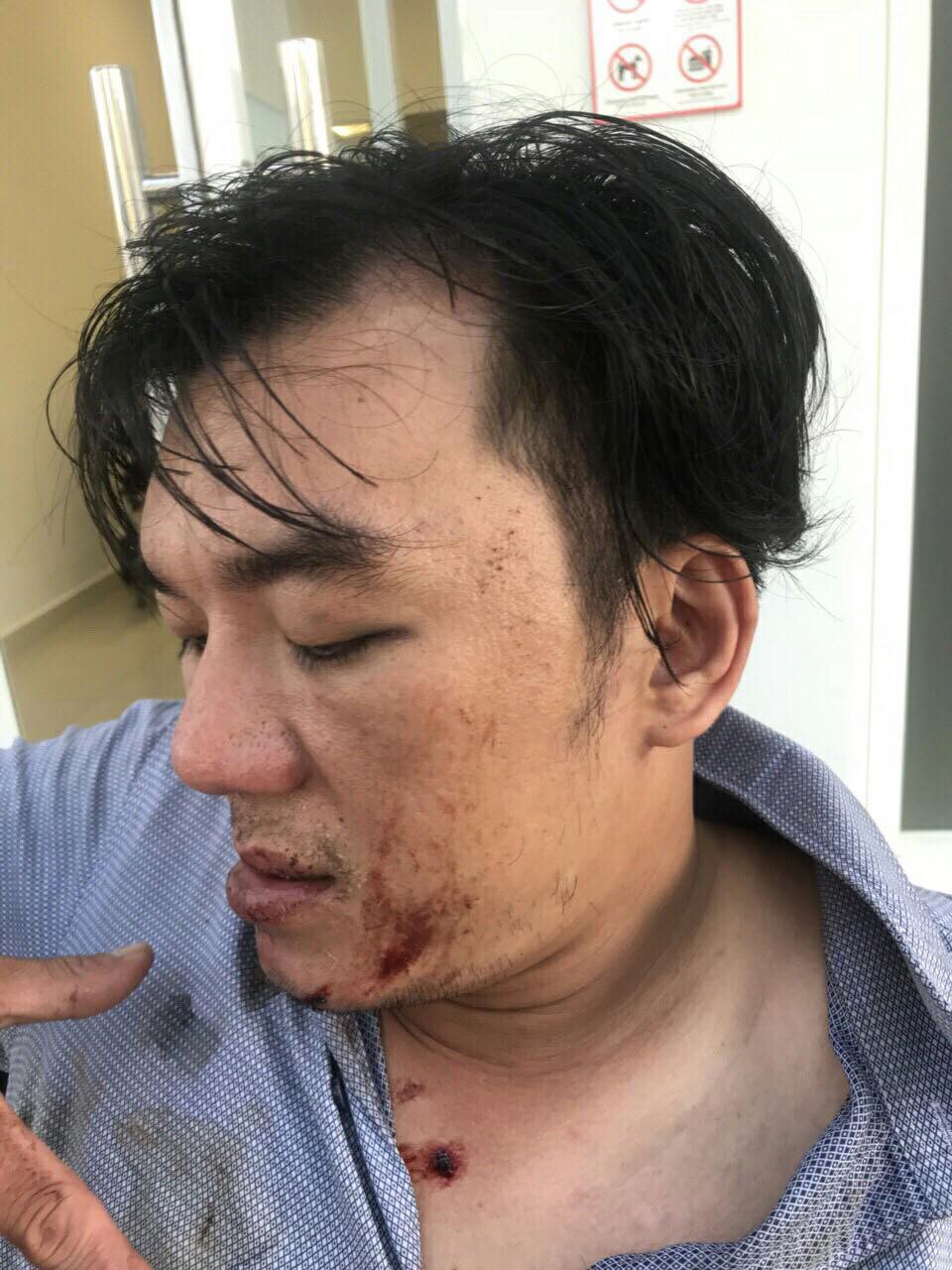 Khách tố bị nhân viên đuổi đánh dã man sau bữa ăn ở Đà Nẵng, quản lý nhà hàng nói gì? - Ảnh 1. Khách tố bị nhân viên đuổi đánh dã man sau bữa ăn ở Đà Nẵng, quản lý nhà hàng nói gì? - Ảnh 1.