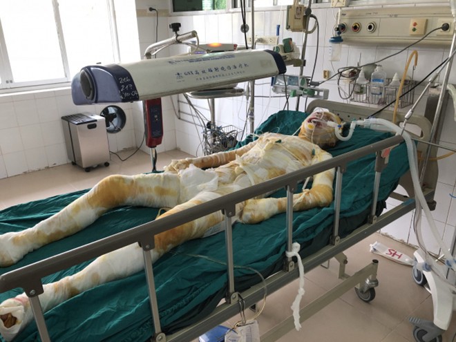 Cô gái bị người yêu tẩm xăng thiêu sống ở Vĩnh Phúc đã qua đời - Ảnh 1. Cô gái bị người yêu tẩm xăng thiêu sống ở Vĩnh Phúc đã qua đời - Ảnh 1.