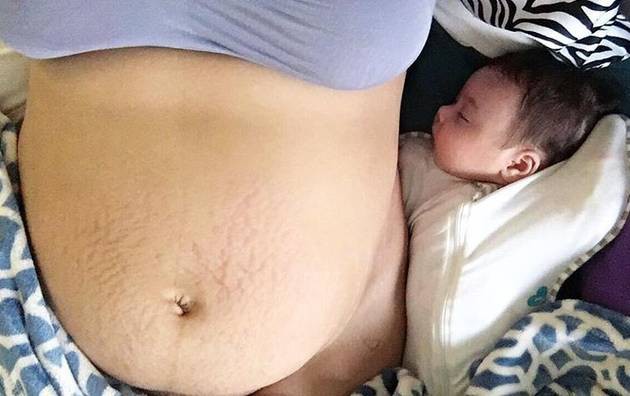 Sự thật trần trụi về cơ thể người phụ nữ sau sinh được lột tả ch&acirc;n thực qua một bức ảnh - Ảnh 2.