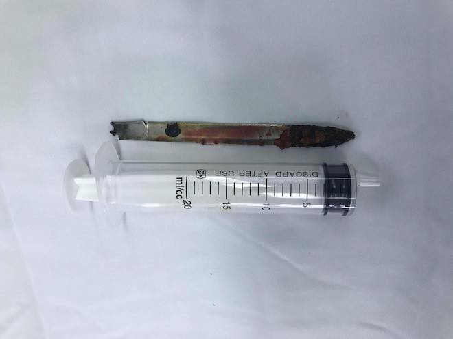 Lưỡi dao bị bỏ qu&ecirc;n trong lưng chiến sỹ c&ocirc;ng an suốt 11 năm - Ảnh 4.