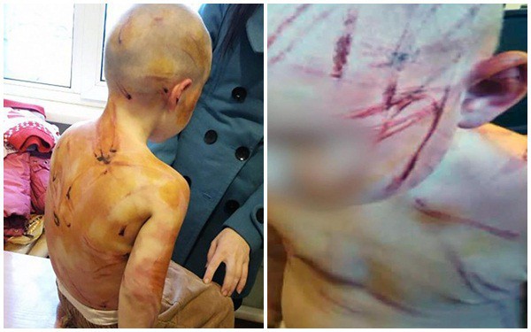 Mẹ dửng dưng đứng nhìn bạn trai đánh đập con gái dã man chỉ vì cô bé không chịu đếm từ 1 tới 5 - Ảnh 1. Mẹ dửng dưng đứng nhìn bạn trai đánh đập con gái dã man chỉ vì cô bé không chịu đếm từ 1 tới 5 - Ảnh 1.