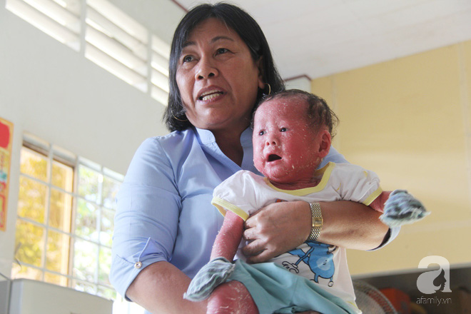 Người đầy vẩy ngứa như da trăn, bé gái 16 tháng tuổi bị bố mẹ bỏ rơi nên không có tiền chữa trị  - Ảnh 7.