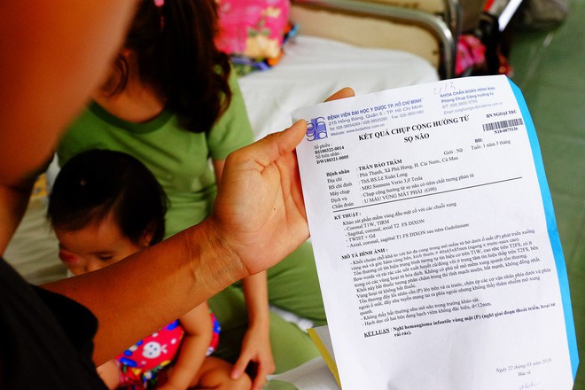 Bé gái gõ cửa 12 bệnh viện để chữa bệnh u mắt hiểm đã sang Singapore tìm phép màu - Ảnh 2.