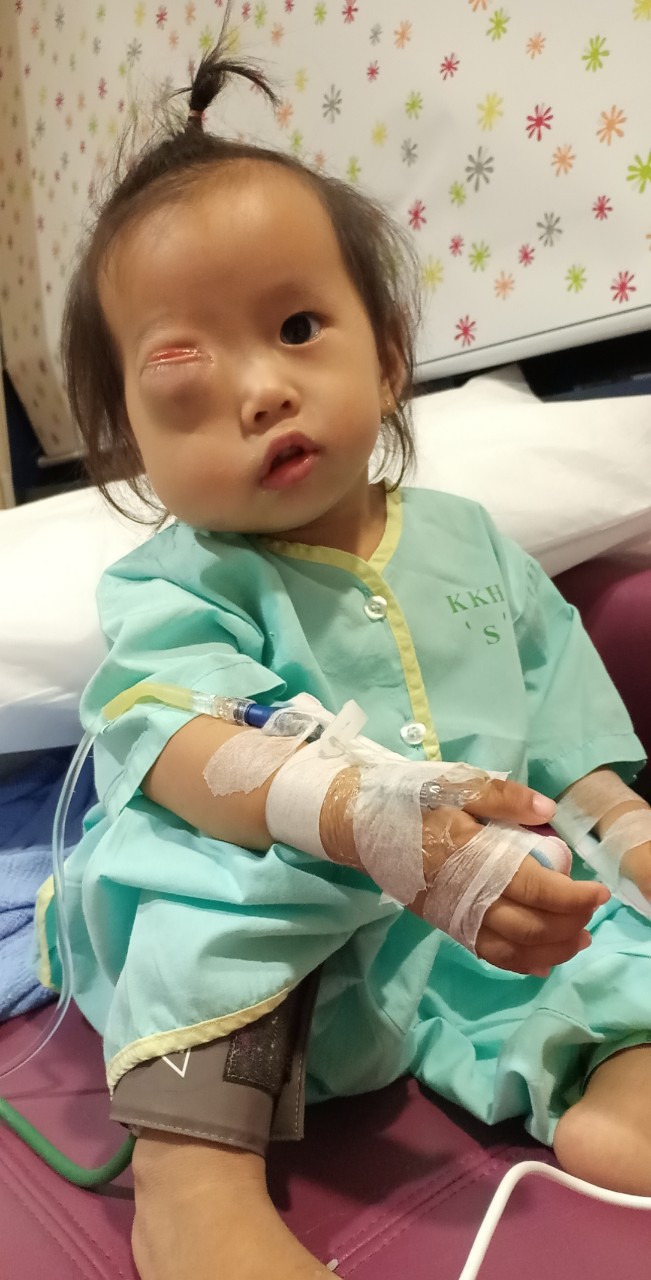 Bé gái gõ cửa 12 bệnh viện để chữa bệnh u mắt hiểm đã sang Singapore tìm phép màu - Ảnh 8.
