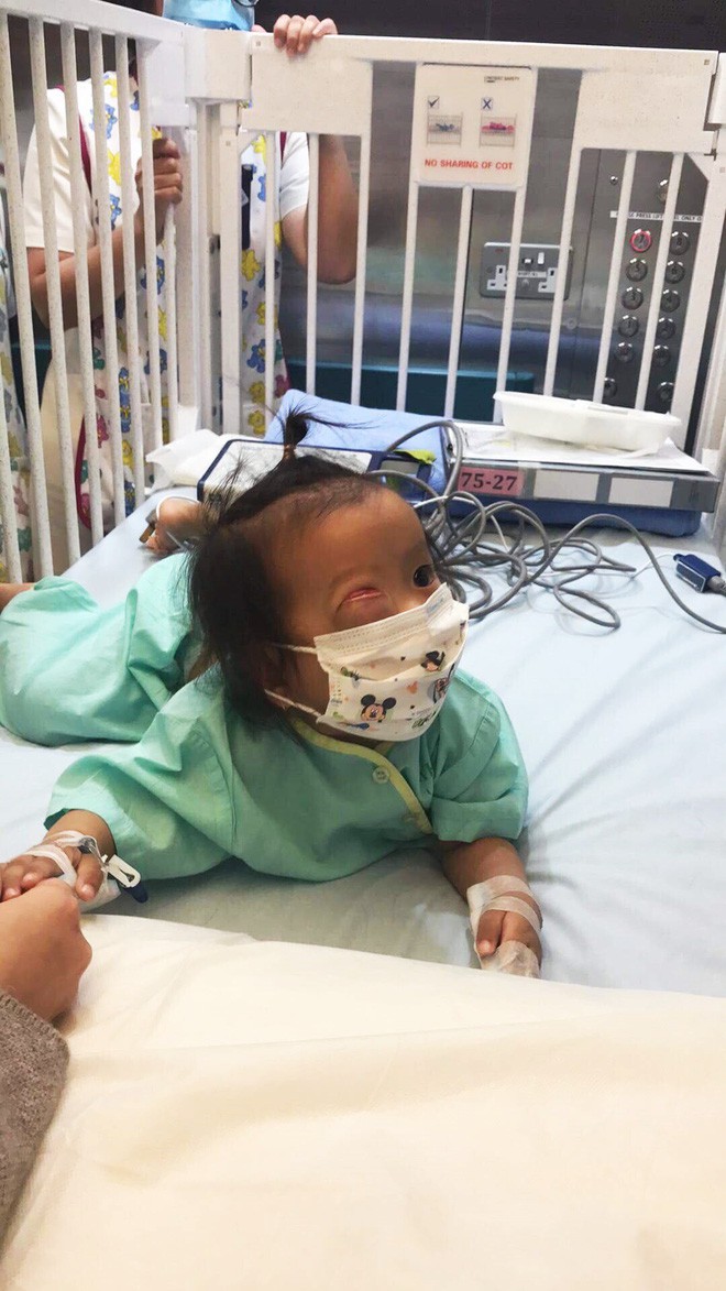 Bé gái gõ cửa 12 bệnh viện để chữa bệnh u mắt hiểm đã sang Singapore tìm phép màu - Ảnh 9.