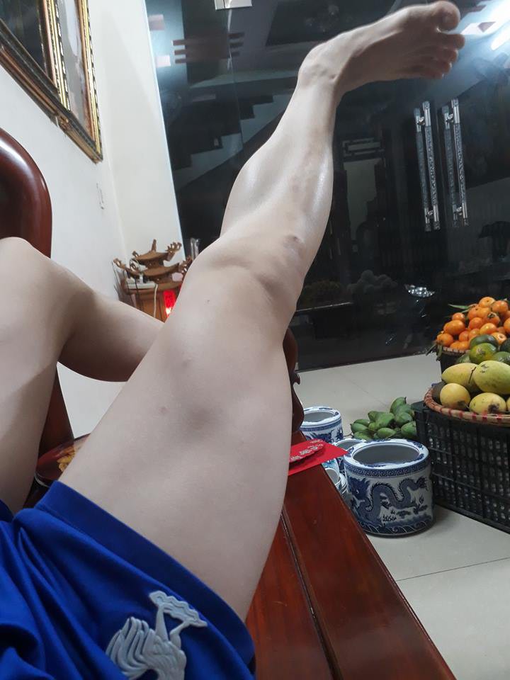Có một nỗi khổ mang tên con trai mà chân tay không một cọng lông, láng mịn hơn cả con gái - Ảnh 19. Có một nỗi khổ mang tên con trai mà chân tay không một cọng lông, láng mịn hơn cả con gái - Ảnh 19.