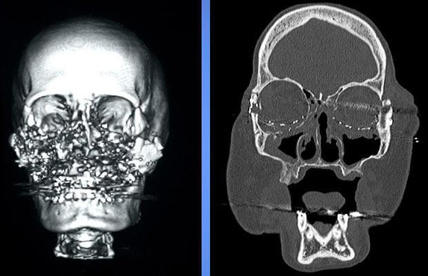 Gã chồng ghen tuông “san phẳng” khuôn mặt vợ bằng một phát súng oan nghiệt, 4 năm sau điều kỳ diệu đã xảy ra - Ảnh 3.