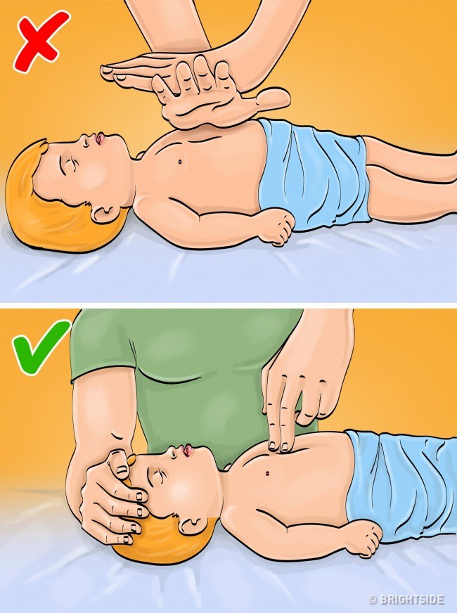 10 cách sơ cứu bạn cần nhớ kỹ để cứu mình thoát hiểm trong trường hợp khẩn cấp - Ảnh 9.