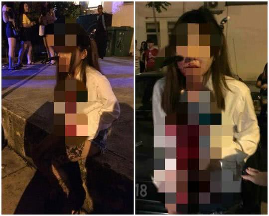 Malaysia: Bị tấn công khi đang bắt taxi, cô gái bình tĩnh đi báo công an với con dao cắm giữa mặt - Ảnh 1.