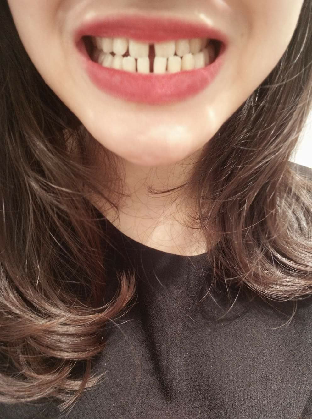 Cô bạn rất xinh cho đến khi nở nụ cười có quyết định đột phá sau 19 năm được dân tình ủng hộ 2 tay - Ảnh 2.