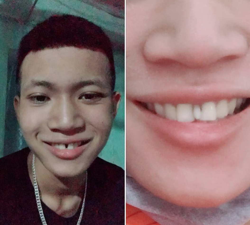 Cô bạn rất xinh cho đến khi nở nụ cười có quyết định đột phá sau 19 năm được dân tình ủng hộ 2 tay - Ảnh 3.