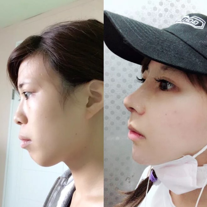 Khoe ảnh PTTM th&agrave;nh c&ocirc;ng, thiếu nữ Nhật được d&acirc;n t&igrave;nh nhận x&eacute;t: Tr&ocirc;ng như vừa đầu thai kiếp kh&aacute;c! - Ảnh 5.