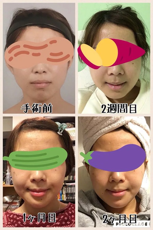 Khoe ảnh PTTM th&agrave;nh c&ocirc;ng, thiếu nữ Nhật được d&acirc;n t&igrave;nh nhận x&eacute;t: Tr&ocirc;ng như vừa đầu thai kiếp kh&aacute;c! - Ảnh 3.