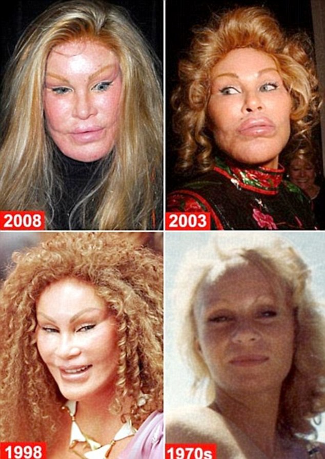 Cuộc đời tai tiếng của “miêu nữ” tỷ phú Jocelyn Wildenstein: Chi núi tiền phẫu thuật giống mèo để chiều chồng, cuối cùng nhận về kết cục đắng ngắt - Ảnh 5.