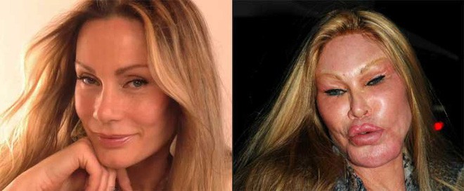 Cuộc đời tai tiếng của “miêu nữ” tỷ phú Jocelyn Wildenstein: Chi núi tiền phẫu thuật giống mèo để chiều chồng, cuối cùng nhận về kết cục đắng ngắt - Ảnh 9.