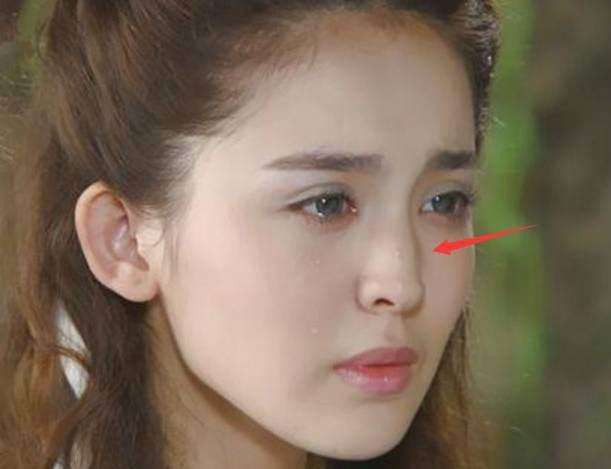 Trịnh Sảng v&agrave; Na Tr&aacute;t: Người thừa nhận thẩm mỹ ng&agrave;y c&agrave;ng đẹp l&ecirc;n, kẻ phủ nhận lại lộ di chứng dao k&eacute;o hỏng? - Ảnh 5.