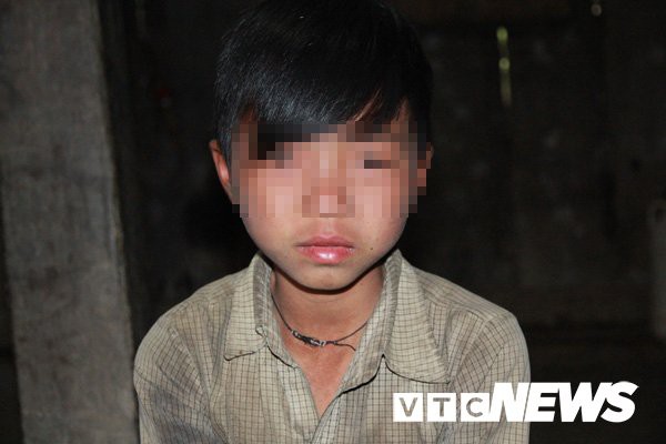 Vùng đất trẻ em có hai của quý ở Hà Giang: Bệnh viện Nhi Trung ương vào cuộc truy nguyên nhân những đứa trẻ bị giời hành - Ảnh 1.