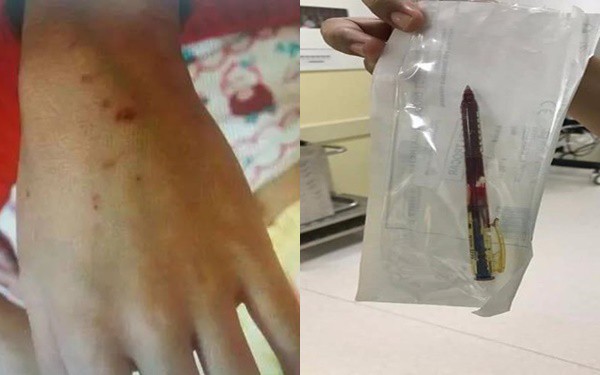Trung Quốc: Giáo viên mầm non dùng bút đâm nhiều em nhỏ khiến phụ huynh bức xúc - Ảnh 1.