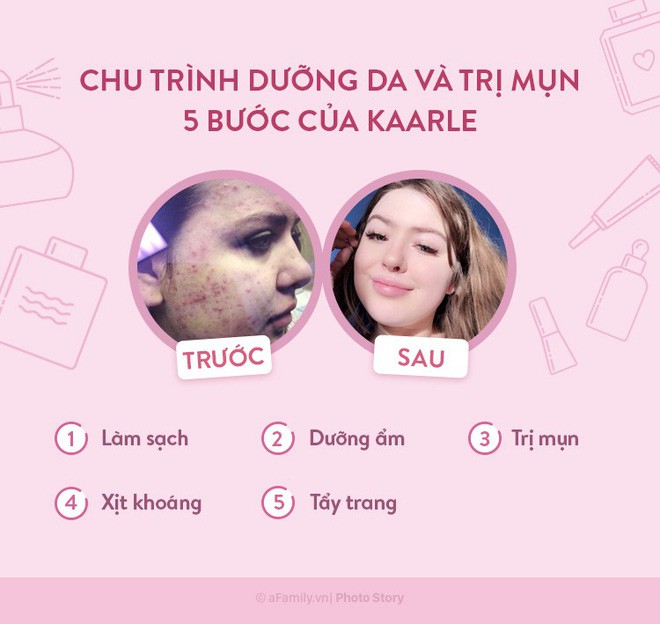 Cô gái này đã “chiến đấu” với mụn nhờ vào chu trình dưỡng da chỉ có 5 bước cơ bản - Ảnh 4.