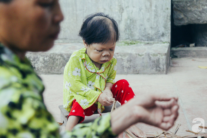 Hạnh phúc không lời của cô gái 30 tuổi mắc kẹt trong cơ thể trẻ lên 3, lớn lên và già đi trên tay mẹ - Ảnh 22.