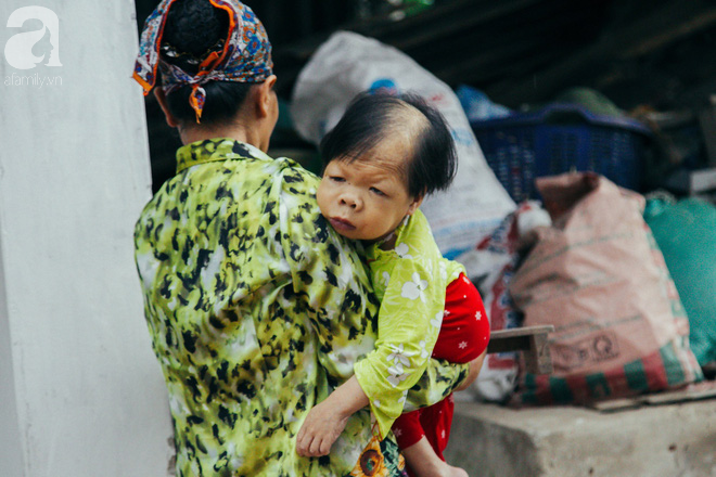 Hạnh phúc không lời của cô gái 30 tuổi mắc kẹt trong cơ thể trẻ lên 3, lớn lên và già đi trên tay mẹ - Ảnh 6.