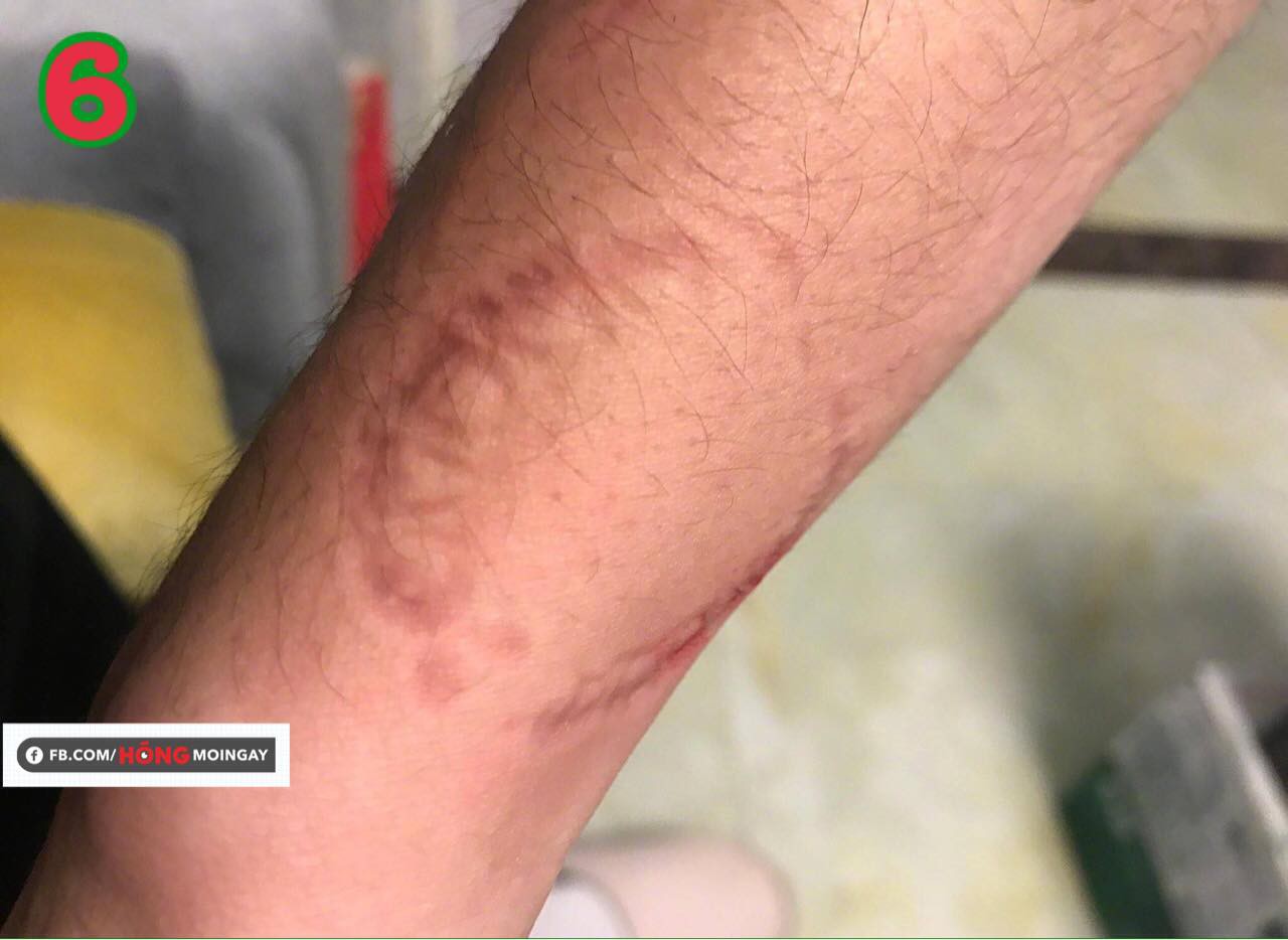 Lỡ cợt nhả với gấu khi đang xấu t&iacute;nh, thanh ni&ecirc;n nhận ngay b&agrave;i học nhớ tới gi&agrave; - Ảnh 6.