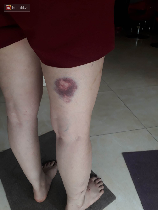 Hà Nội: Chủ tiệm tóc kể lại khoảnh khắc nghẹt thở khi cùng nhân viên và nữ chủ xe SH giằng co với tên cướp có dao - Ảnh 4.