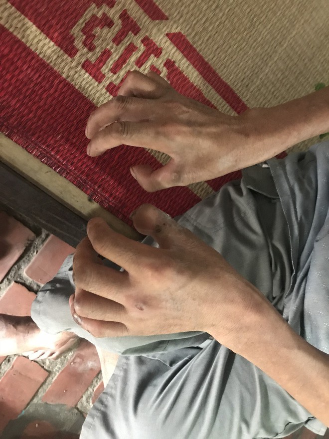 Từ ngày bị liệt và 2 mắt mờ đi, đêm nào tôi cũng nằm khóc vì thương chồng, thương con - Ảnh 4.