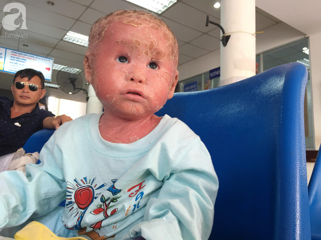 Bé Bích bị vẩy ngứa da trăn mong muốn ngưng nhận tiền ủng hộ vì còn nhiều hoàn cảnh đáng thương khác - Ảnh 5.