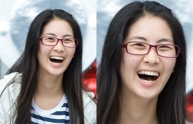 Mặt mộc chân thật nhất của sao Kpop: Người đẹp khó tin, kẻ gây sốc vì da rỗ và mặt mụn - Ảnh 15. Mặt mộc chân thật nhất của sao Kpop: Người đẹp khó tin, kẻ gây sốc vì da rỗ và mặt mụn - Ảnh 15.