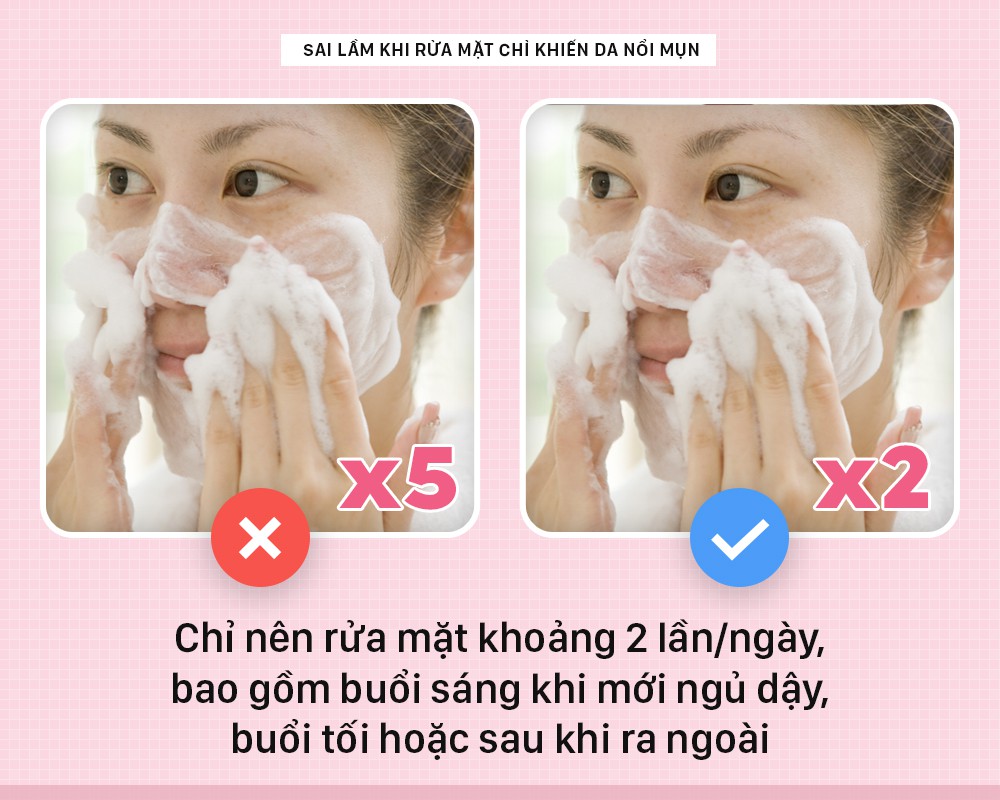 Nếu bạn cứ giữ những thói quen này khi rửa mặt thì chỉ khiến da nổi mụn nhiều hơn - Ảnh 3.