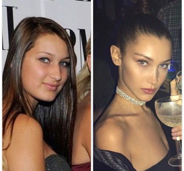 Nhan sắc thay đổi rõ rệt, Bella Hadid gây tranh cãi vì vẫn chối không đập mặt xây lại - Ảnh 2.