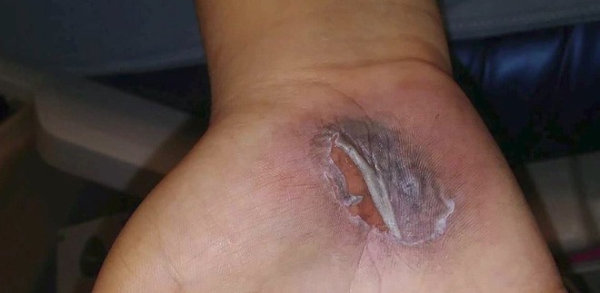 Mỹ: Con đi học về với đ&ocirc;i b&agrave;n tay trầy trụa, mẹ b&aacute;o nh&agrave; trường v&agrave; cảnh s&aacute;t v&agrave;o cuộc điều tra ngay lập tức - Ảnh 4.