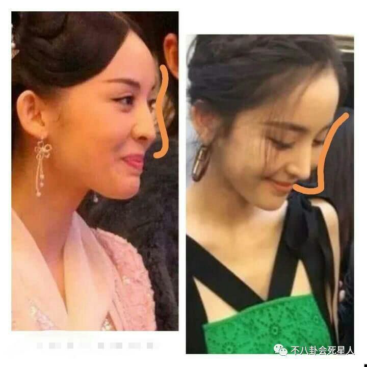 Nghịch lý showbiz: Người thừa nhận dao kéo ngày càng đẹp tự nhiên, kẻ chối bay chối biến lại lộ di chứng thẩm mỹ - Ảnh 41. Nghịch lý showbiz: Người thừa nhận dao kéo ngày càng đẹp tự nhiên, kẻ chối bay chối biến lại lộ di chứng thẩm mỹ - Ảnh 41.