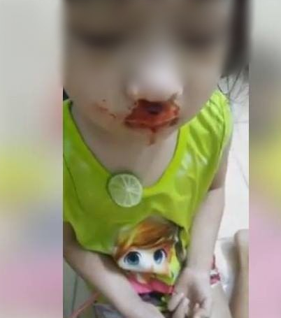 Mẹ vừa đánh con gái chảy máu mũi vừa livestream khiến dư luận dậy sóng, ông ngoại lên tiếng: Mẹ nó tô son để quay clip vui - Ảnh 1.
