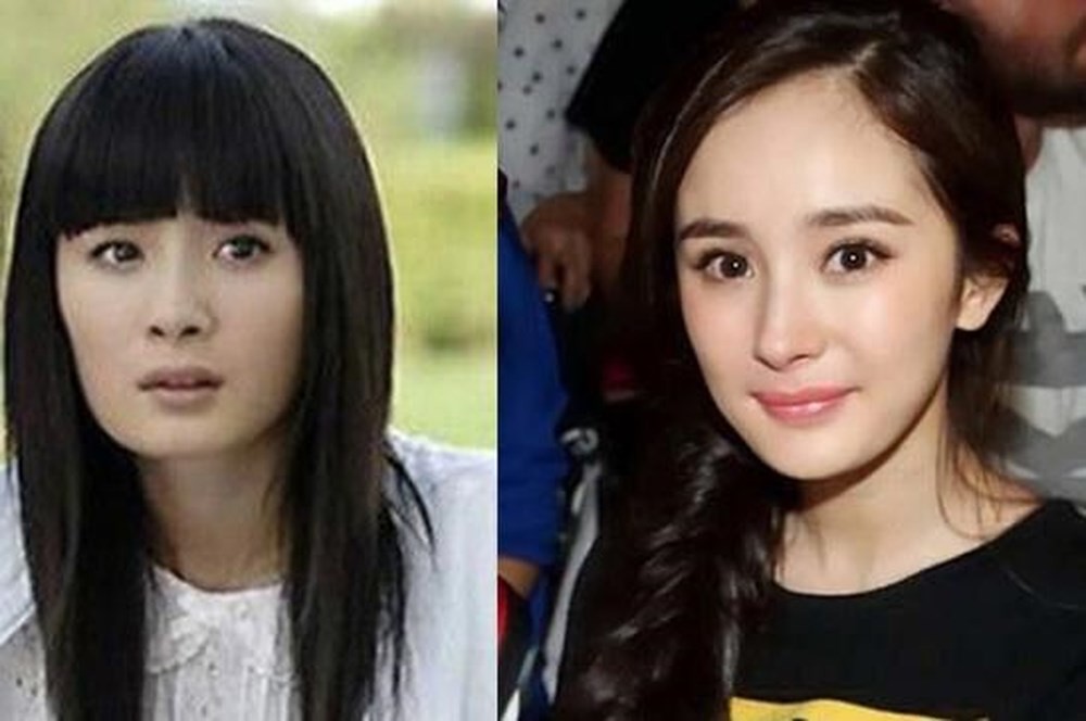 Nghịch lý showbiz: Người thừa nhận dao kéo ngày càng đẹp tự nhiên, kẻ chối bay chối biến lại lộ di chứng thẩm mỹ - Ảnh 31. Nghịch lý showbiz: Người thừa nhận dao kéo ngày càng đẹp tự nhiên, kẻ chối bay chối biến lại lộ di chứng thẩm mỹ - Ảnh 31.