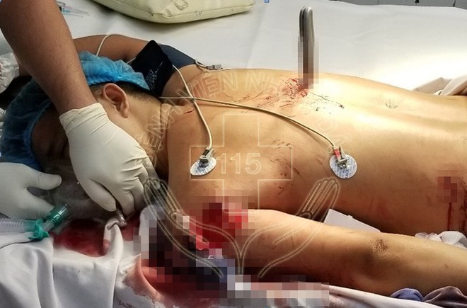 TP.HCM: Người đàn ông bị dao đâm xuyên ngực thấu tủy được cứu sống ngoạn mục  - Ảnh 2.