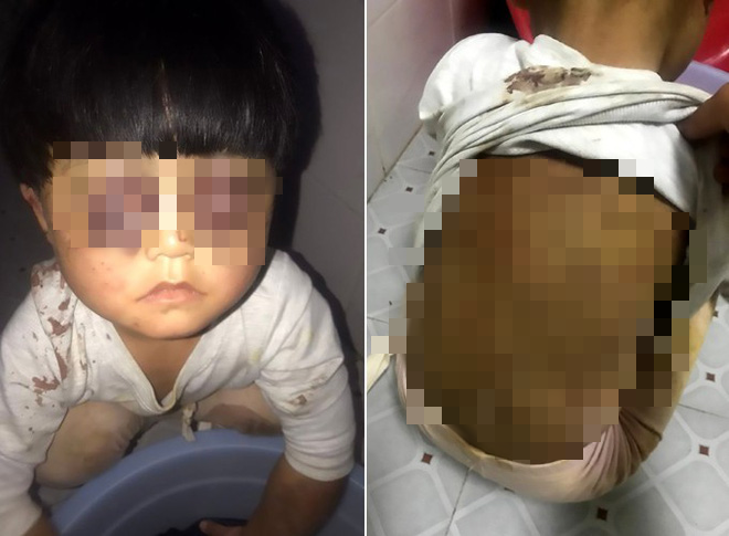 Trung Quốc: phẫn nộ v&igrave; b&eacute; g&aacute;i 4 tuổi bị bố đ&aacute;nh đập h&agrave;nh hạ, x&iacute;ch trong nh&agrave; vệ sinh tối tăm 16 tiếng 1 ng&agrave;y - Ảnh 1.