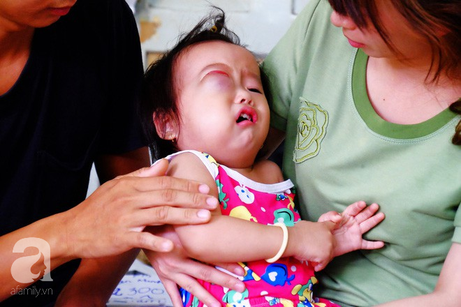 Em bé 2 tuổi ở Cà Mau bị u mắt nguy hiểm, bố mẹ nghèo cố tìm cách cứu con trong tuyệt vọng - Ảnh 2.