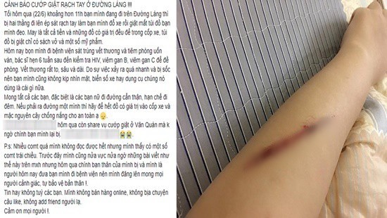 C&ocirc; g&aacute;i tố bị rạch tay, cướp t&uacute;i x&aacute;ch tr&ecirc;n đường phố H&agrave; Nội thế nhưng sự thật được h&eacute; lộ ngay sau khi C&ocirc;ng an v&agrave;o cuộc - Ảnh 1.