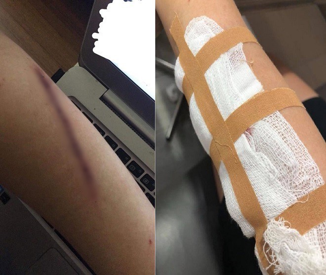 C&ocirc; g&aacute;i tố bị rạch tay, cướp t&uacute;i x&aacute;ch tr&ecirc;n đường phố H&agrave; Nội thế nhưng sự thật được h&eacute; lộ ngay sau khi C&ocirc;ng an v&agrave;o cuộc - Ảnh 2.