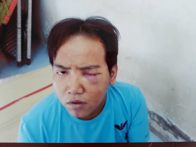 Bảo vệ dân phố cắt cổ bé trai 6 tuổi ở Sài Gòn được thoát án tù vì bị bệnh tâm thần - Ảnh 2.